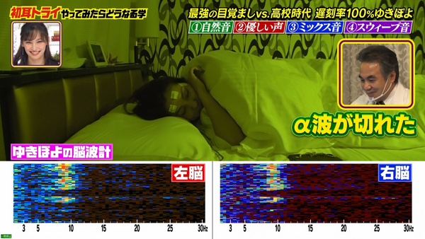 セルシネ・エイム研究所/和田知浩。終夜睡眠脳波測定。覚醒アルファ波(α)の消失で入眠した時。経時的脳波分布グラフによる睡眠ステージ判定。 入眠(寝落ち)した瞬間の脳波。αブロッキング