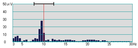 BrainProFM-929で測定した「パルラックスF」の画面。セルシネ・エイム研究所 BrainProFM-929で測定した「パルラックスF」の画面。