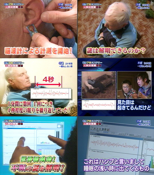 不眠男性のマイクロスリープを脳波で捉えた? セルシネ・エイム研究所 不眠男性のマイクロスリープを脳波で捉えた?