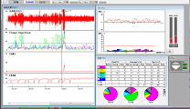 脳波解析PCソフト「マインドセンサー５」