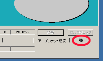 パルラックス・ライトのアーチファクト感度が「強」になった画像