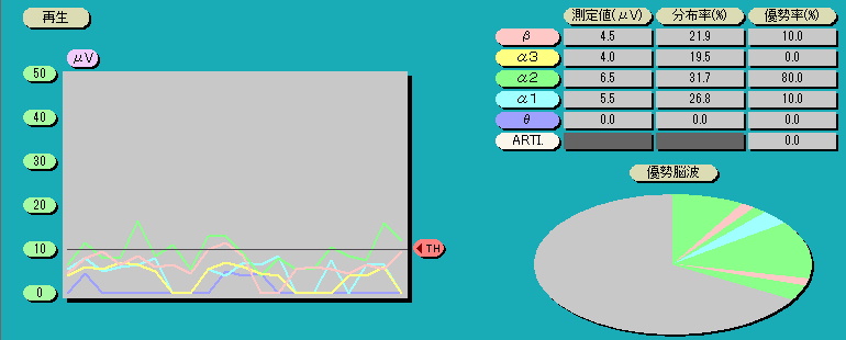 脳波解析PCソフト「パルラックス・ライト」の真横折れ線グラフ