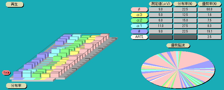 脳波解析PCソフト「パルラックス・ライト」の立体棒グラフ
