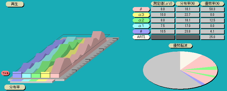 脳波解析PCソフト「パルラックス・ライト」の立体折れ線グラフ