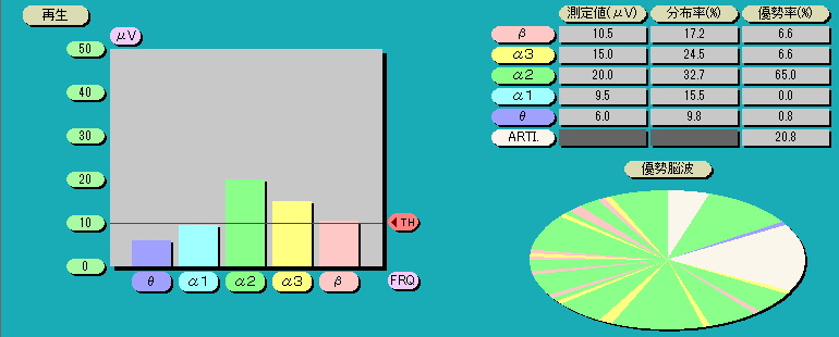 脳波解析PCソフト「パルラックス・ライト」の正面棒グラフ