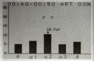 脳波測定器「FM-828」液晶モニターの測定画面。