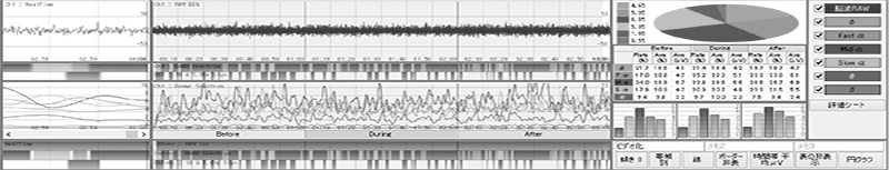 脳波解析PCソフト「マインドセンサー７」
