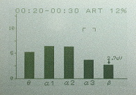 BrainProuFM-929v{̂̃g[jO[hu_Otʁv