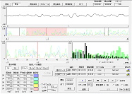 脳波解析PCソフト「Pullax-pro」（オプション）