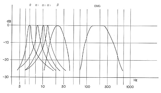 FM-515Aのフィルター特性