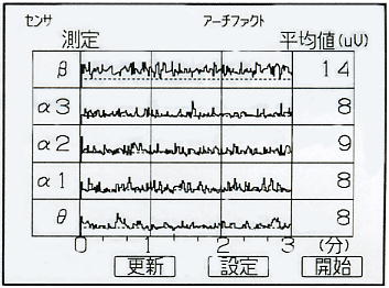 FM-717̉ʗu܂Otv