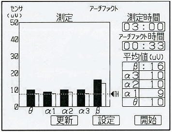 FM-717̉ʗurOtv