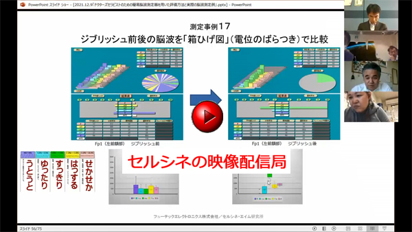 ドクターズセラピストのための簡易脳波測定器を用いた評価方法と実際の脳波測定例