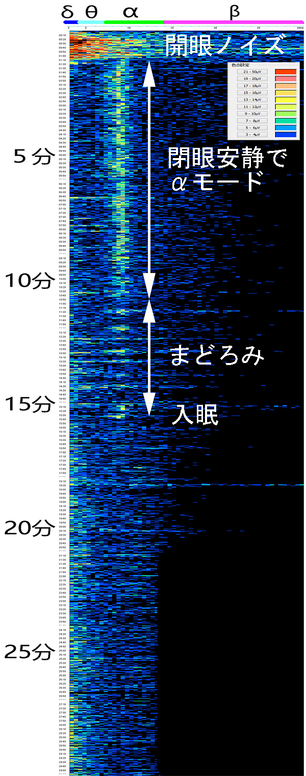 北海道の知人が真夏の東京に来たとき一言。「日中暑いのは我慢できるけど、夜中も暑いままなのが疲れる・・・」。快眠さえできれば、日中のハードワークも意欲的に取り組めるものです。私は医師ではないので治療はしませんが、脳波測定で自らてんかん発作や睡眠などを統御できる人が出てきます。脱力！