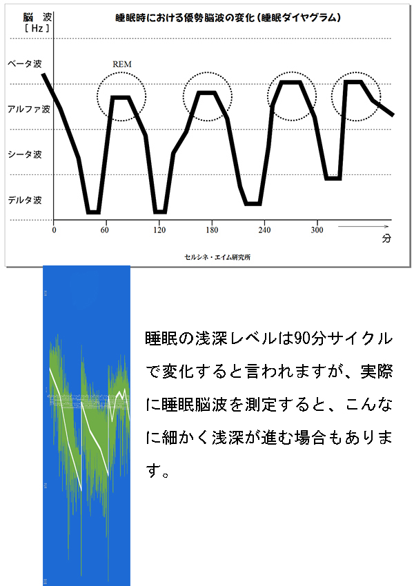 睡眠の浅深レベルは90分サイクルで変化すると言われますが、実際に睡眠脳波を測定すると、こんなに細かく浅深が進む場合もあります。セルシネの「脳波測定／脳コン解析サービス」