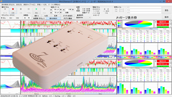 高性能簡易脳波測定器「アルファテック７」の致命的問題が解決したので、脳波測定／脳コン解析サービスでの利用を再開しました。販売／レンタルは引き続き控えます。