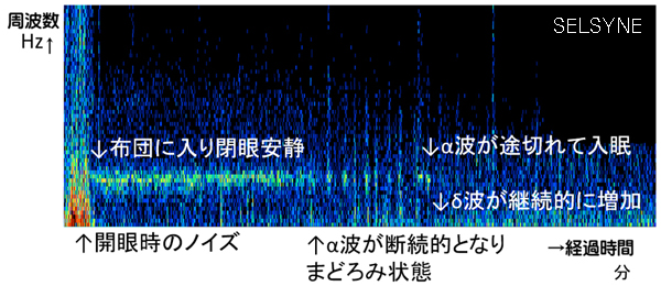 おはようございます。スッキリお目覚めですか？　被験者の睡眠リズムが直観的に把握できます。終夜睡眠脳波の分布グラフ。セルシネの脳波測定／脳コン解析サービス。