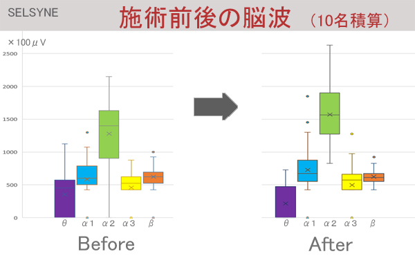 あなたのその課題、脳波測定で解決しませんか？　このグラフは、被験者10名の脳波を積算した施術前後の比較です。α２とα１が活性化し、β波は沈静化しました。統計学的有意性も、施術の効果を肯定するものでした。セルシネの脳波測定／脳コン解析サービス 