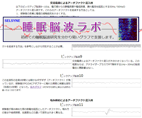 セルシネの「睡眠脳波ラボ」に、アナライザープラスのRAW波形に現れる交流電源と噛み締めによるアーチファクト例を掲載しました。アーチファクト混入波形を知って、純粋な脳波波形と見分けることが大切です。